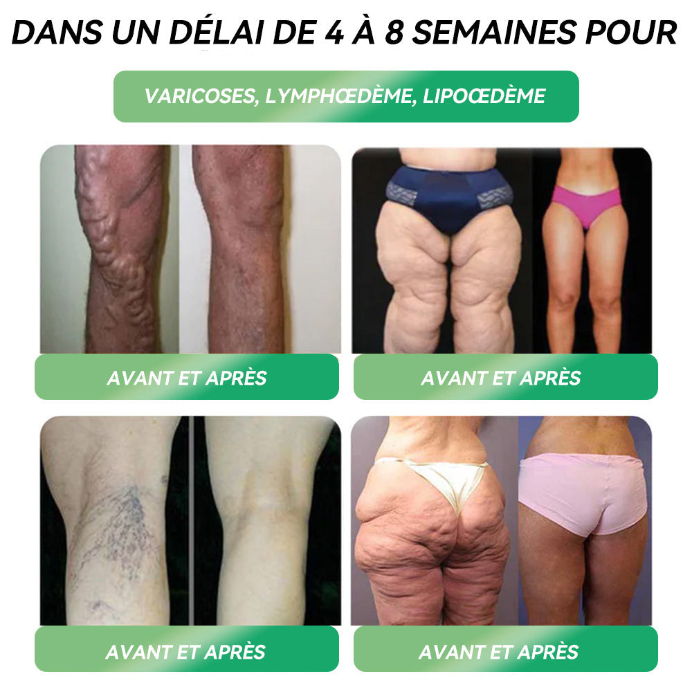 Boutique Officielle | 𝑆𝑇𝐷𝐸𝐼®✅ Solution Orale 𝐺𝐿𝑃-1 pour la 𝑝𝑒𝑟𝑑𝑒 𝑑𝑒 𝑝𝑜𝑖𝑑𝑠 – 👨⚕️ Pour lutter contre l’𝑜𝑏𝑒́𝑠𝑖𝑡𝑒́, les maladies 𝑐𝑎𝑟𝑑𝑖𝑜𝑣𝑎𝑠𝑐𝑢𝑙𝑎𝑖𝑟𝑒𝑠, le 𝑑𝑖𝑎𝑏𝑒̀𝑡𝑒, l’𝑎𝑝𝑛𝑒́𝑒 𝑑𝑢 𝑠𝑜𝑚𝑚𝑒𝑖𝑙, les 𝑝𝑟𝑜𝑏𝑙𝑒̀𝑚𝑒𝑠 𝑎𝑢𝑥 𝑎𝑟𝑡𝑖𝑐𝑢𝑙𝑎𝑡𝑖𝑜𝑛𝑠 et bien plus encore🪷